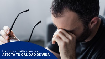 La conjuntivitis alérgica afecta tu calidad de vida